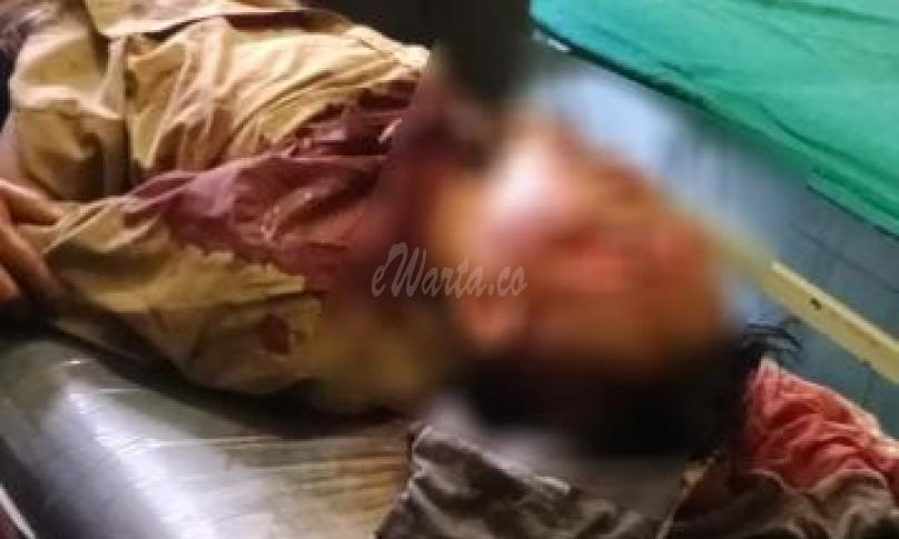 Tabrak dump truk, pelajar di seluma MD