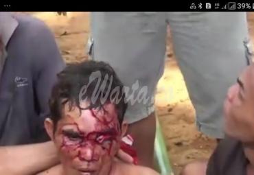 Ridwan korban terkaman Beruang di Seluma